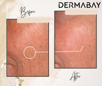 Dermabay Retinol 0.2% Face Serum