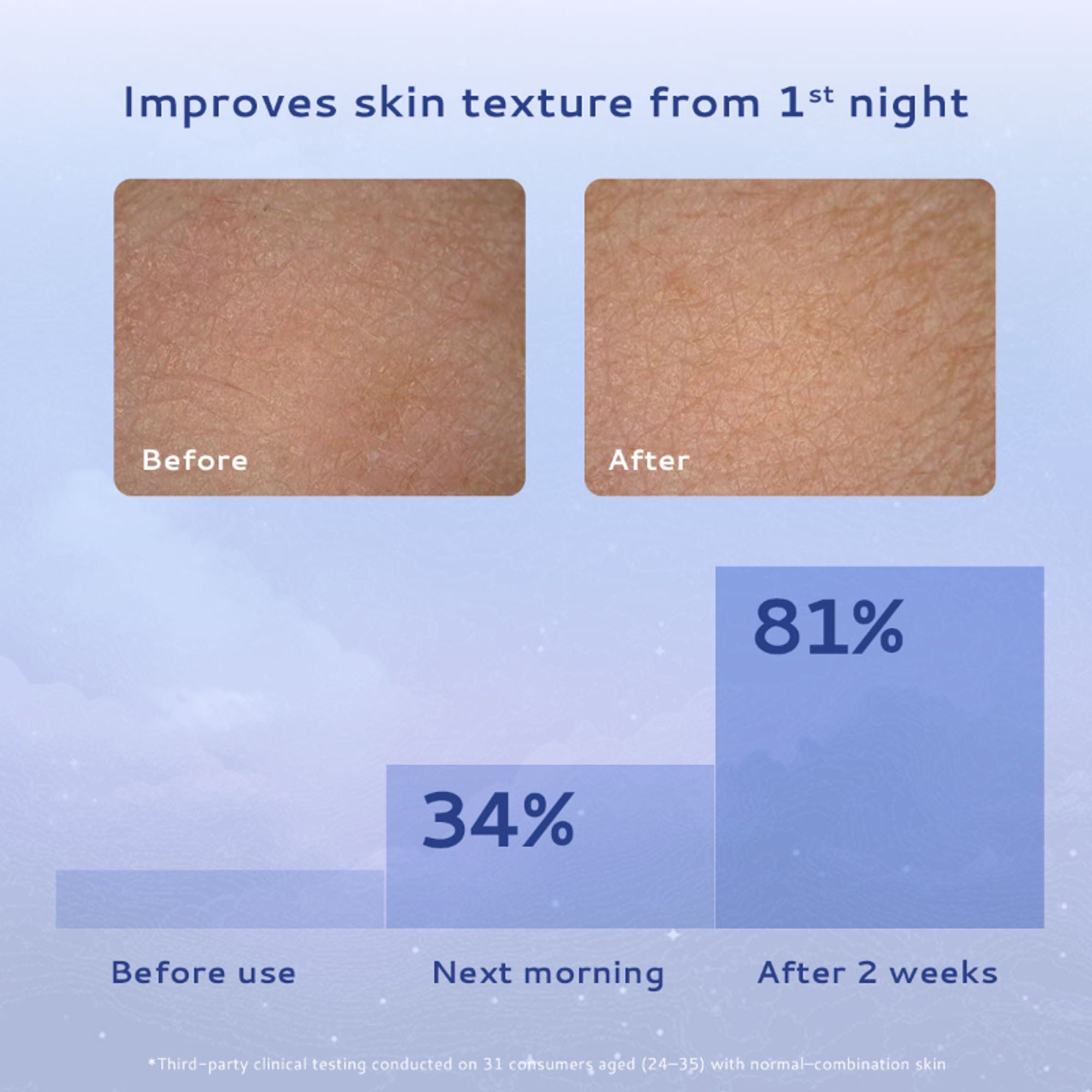 Lumineve Combination Skin Moisturizer with Niacinamide - Lightweight Gel For Oil-Free Hydration
