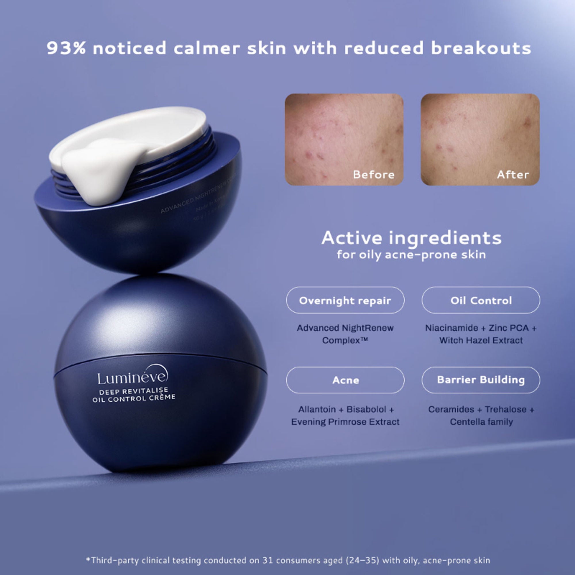 Lumineve Lightweight Moisturizer for Oily & Acne Prone Skin with Niacinamide for Hydrating Skin