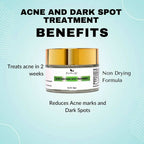 The Wellness Shop Acne and Dark Spot Treatment Cream