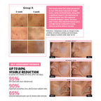 Indulgeo Essentials Cica Reedle Essence With PDRN