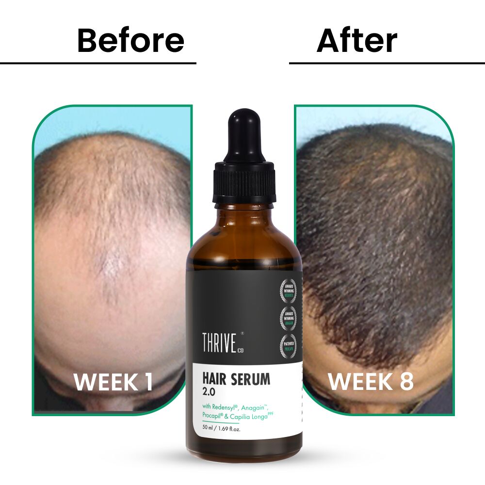 ThriveCo Hair Growth Serum 2.0 - Distacart