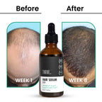 ThriveCo Hair Growth Serum 2.0 - Distacart