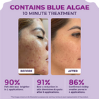 Sanfe 25% AHA + 2% BHA Exfloating Peeling Solution