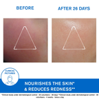 Uriage Xemose Face Cream