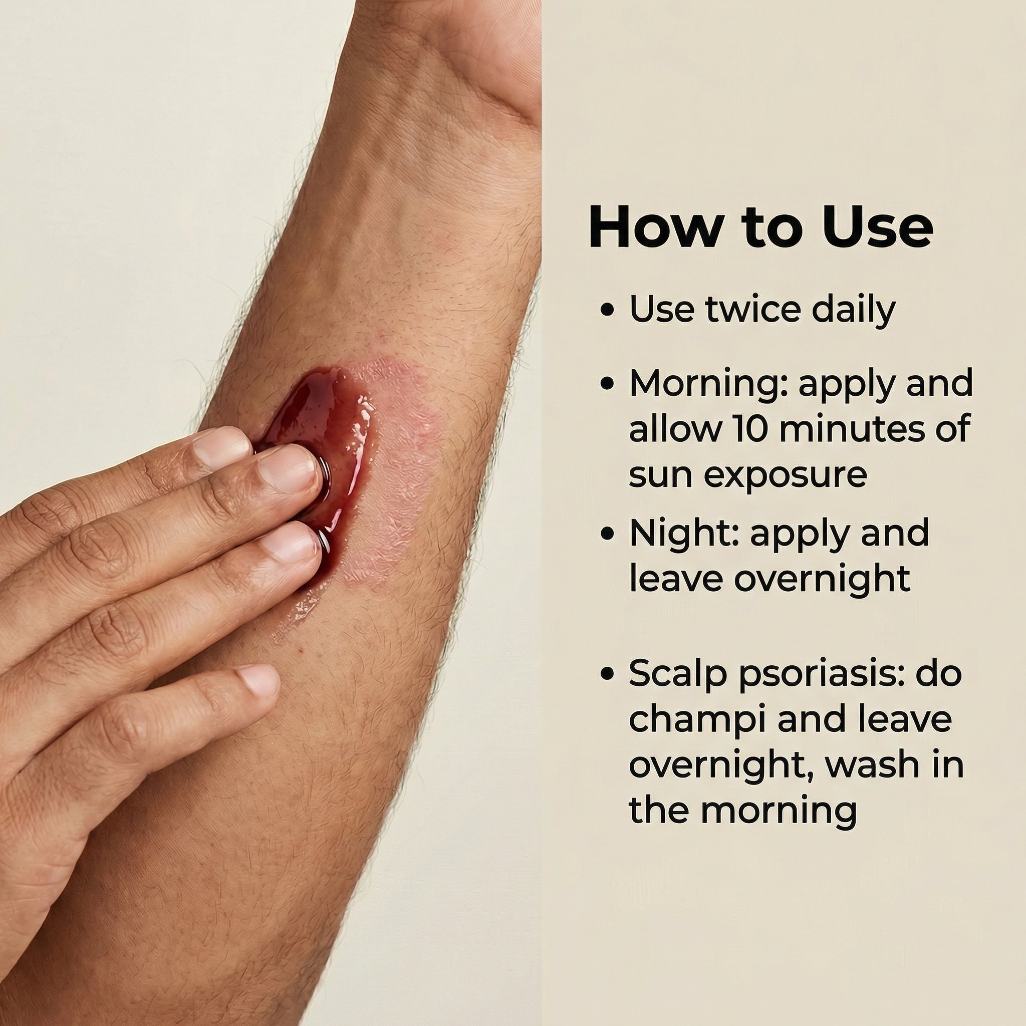 Vedicderm Psoriasis Oil 2-in-1 Skin + Scalp Relief Oil - Distacart