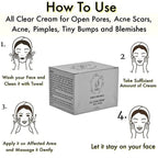 Saroj Organics All Clear Cream For Acne, Pimples