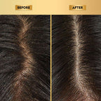 The Skin Story Anti-Dandruff Hair Scalp Serum