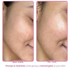 The Skin Diet Company Beetroot Moisturiser Lightweight, Non-Greasy - Dry/Oily Skin + Hyaluronic Acid
