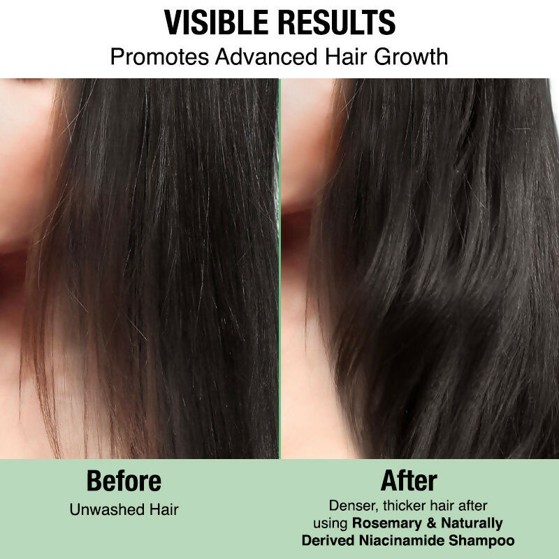 Nykaa Naturals Advanced Hair Growth Shampoo With Rosemary & Naturally Derived Niacinamide