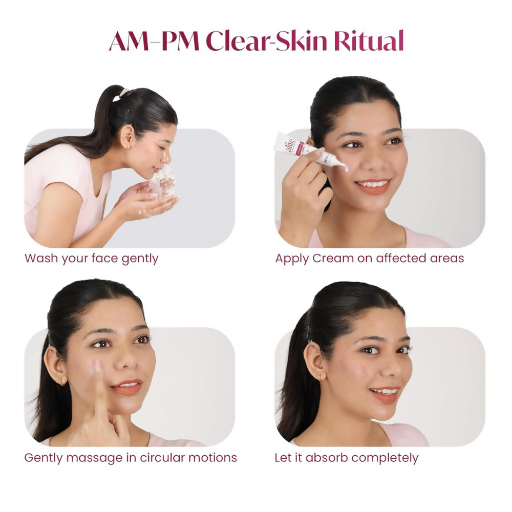Alite Spots Reduction Cream with 5X Enhanced Absorption - Distacart