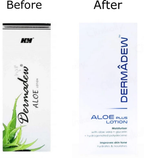 Dermadew Aloe Plus Moisturiser Lotion - Distacart