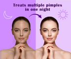 Urban Yog Acne Curvy Pimple Patch - Invisible Facial Stickers cover