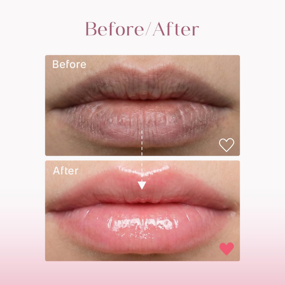 Seoulskin Brightening Lip Balm with SPF 50 PA++ - Distacart