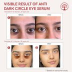 Ivory Natural Dark Circle Eye Serum For Dark Eye Circles, Under-Eye Patches, Swollen Eyes
