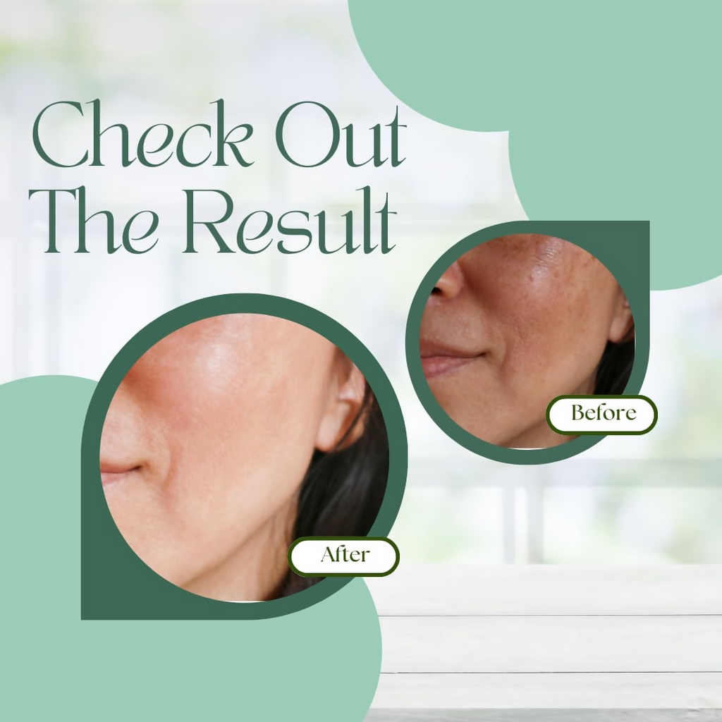 Skinaa Ocevia Skin Brightening Cream