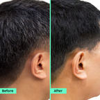 PLIX The Plant Fix Rosemary Advanced Hair Kit