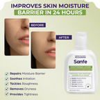 Sanfe Moisturising Lotion Improves skin moisture in 24 hour Moisturizer