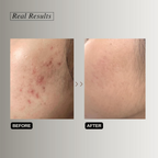 The Formularx Renaissance Gentle Retinol Complex Serum With Niacinamide & Bakuchiol