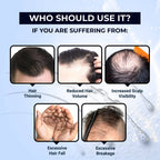 The Man Company Hair Growth Tonic