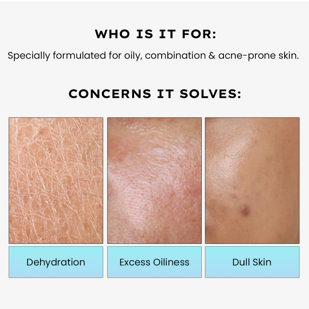 Hyphen 2% Cica Exosome Oil-Free Moisturizer 5% Niacinamide Controls Oil Non-sticky, Light Gel - Distacart
