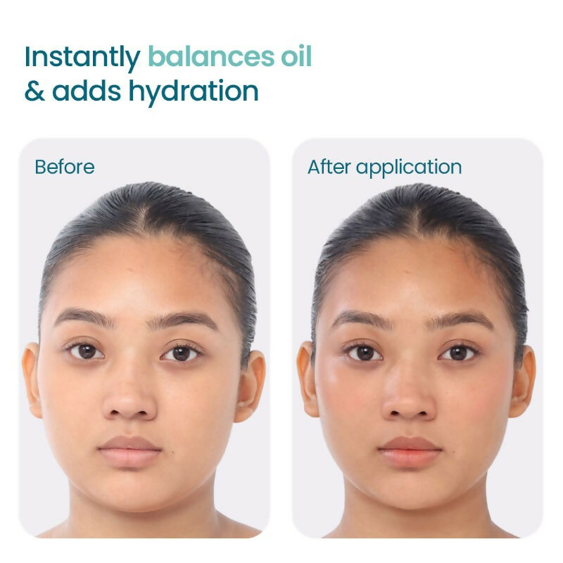 Wishcare 2:1:3 NMF Water Gel Moisturizer for Oily & Sensitive Skin, Oil-Free - Distacart