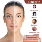 Heal N Cure NG Glow Cream - Distacart
