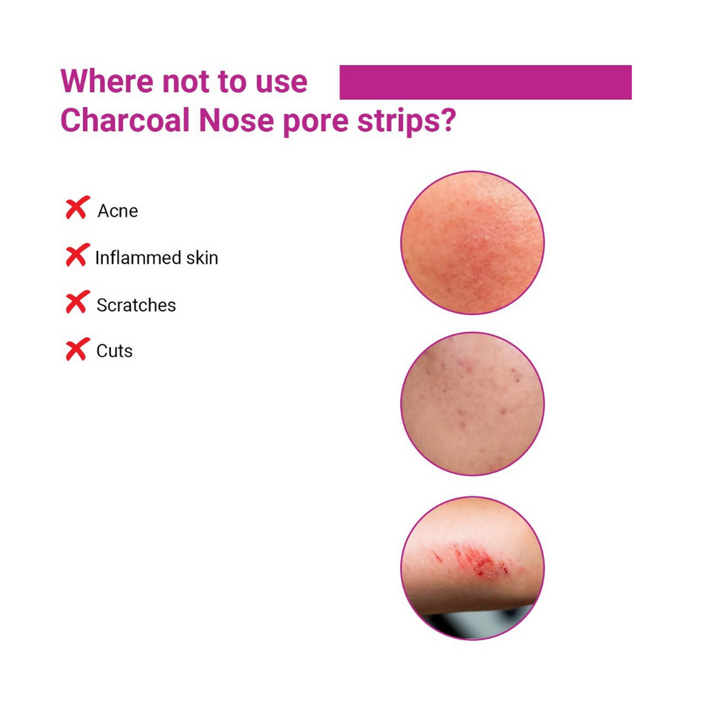 Sotrue Charcoal Nose Pore Deep Cleansing Strips - Distacart