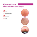 Sotrue Charcoal Nose Pore Deep Cleansing Strips - Distacart