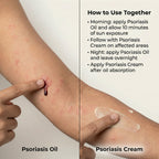 VedicDerm Sensitive Skin Bundle for Psoriasis, Eczema, Atopic Dermatitis - Distacart