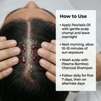 VedicDerm Sensitive Scalp Bundle for Psoriasis, Dandruff, & Itchy Scalp - Distacart