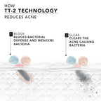 Novology Acne Reduction Serum With 0.1% Thymol + Terpineol - Distacart
