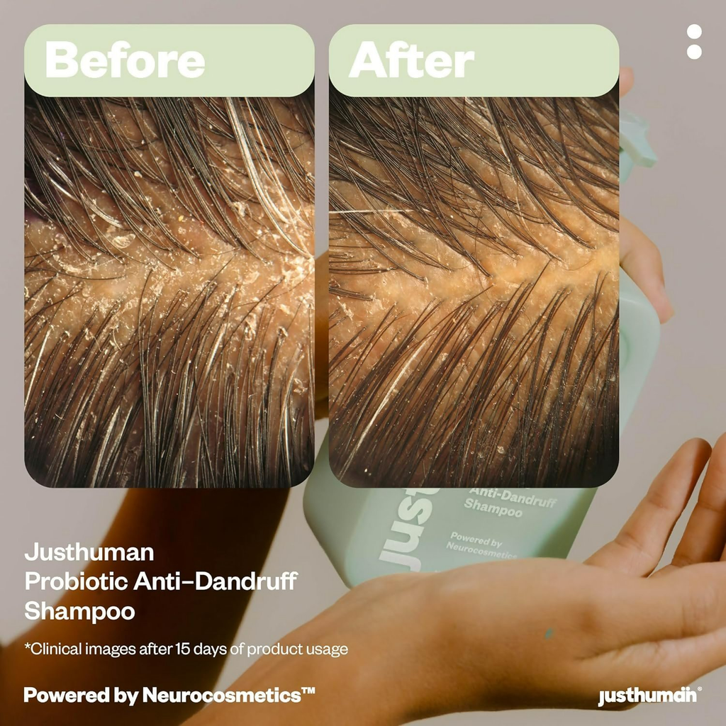 JustHuman Probiotic Anti Dandruff Shampoo - Distacart