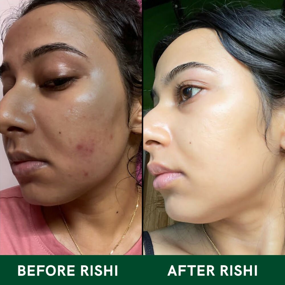 Copy of SKIN GLOW TEA BEFORE AFTER