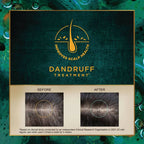 Indulekha Svetakutaja Anti-Dandruff Hair Oil - Distacart
