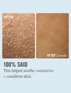 First Aid Beauty Ultra Repair Cream