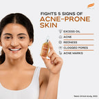 Himalaya Herbals Acne Clear+ Scar Removal Serum