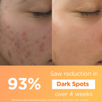 Light Up Thd Ascorbate Vitamin C Face Serum For Glowing Skin
