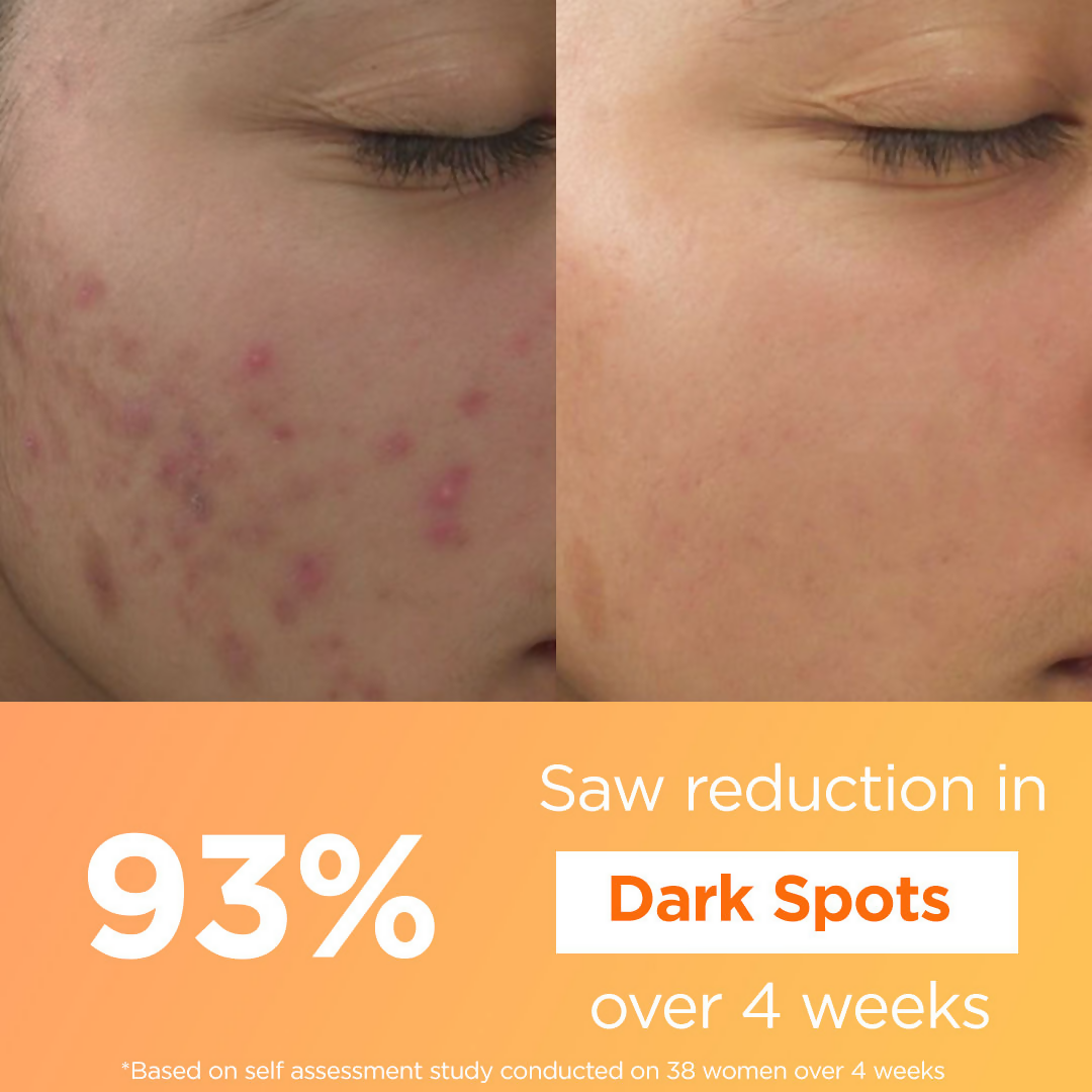 Light Up Thd Ascorbate Vitamin C Face Serum For Glowing Skin
