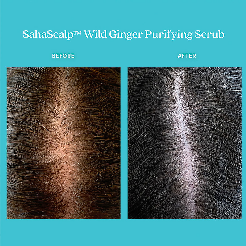 Fable & Mane Sahascalp Purifying Scrub To Gently Exfoliate Scalp With Wild Ginger&Pink Himalayan Salt
