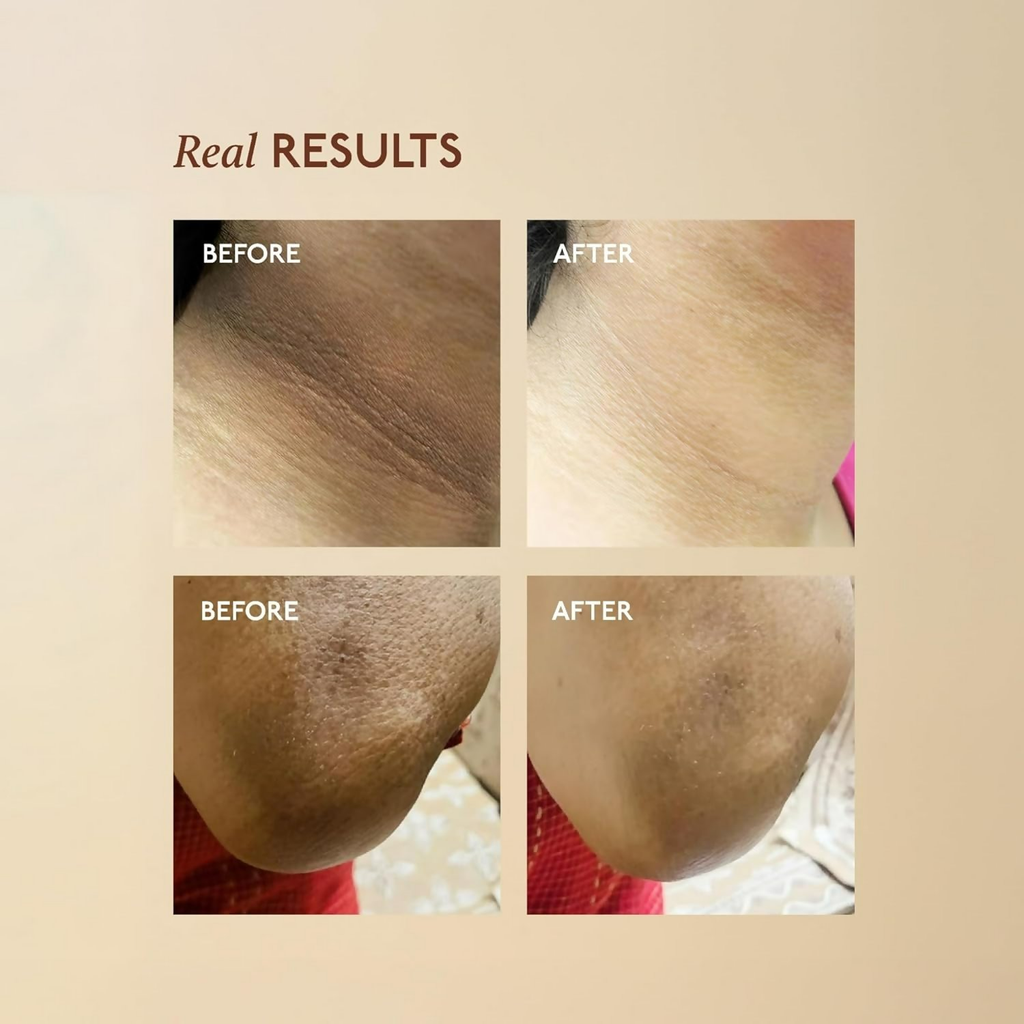 Asaya Tone Restore Advanced Pigmentation Cream with MelaMe Complex - Distacart