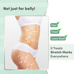 Mylo Care Stretch Marks Oil - with Sea Buckthorn
