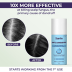 Sanfe Anti Dandruff One Wash Shampoo