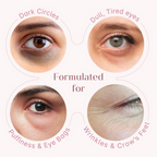 Seoulskin Under Eye Cream - Distacart