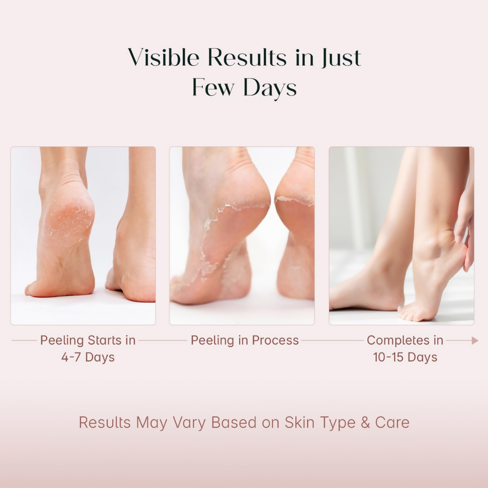 Seoulskin Glycolic Acid Foot Peeling Mask - Distacart