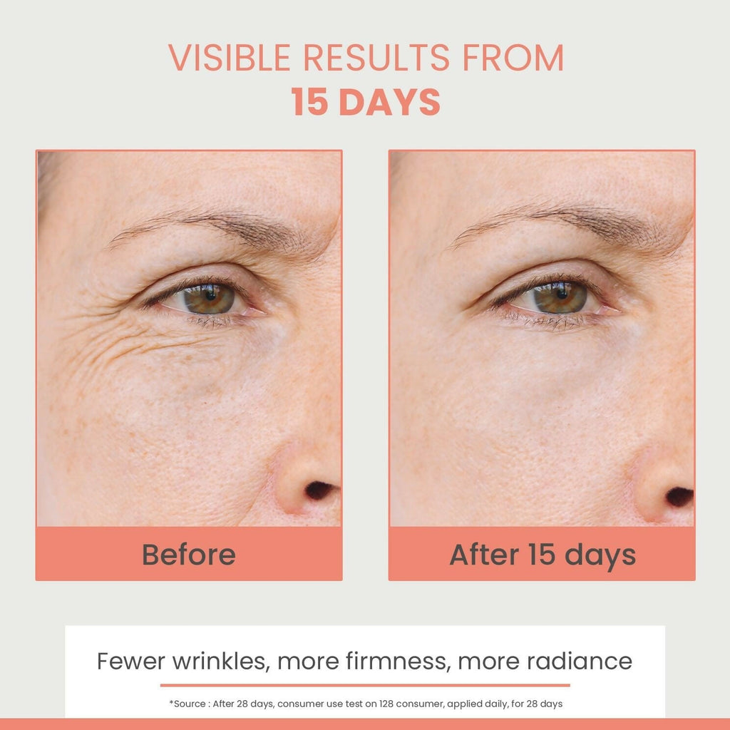 Avene Hyaluron Activ B3 Concentrated Plumping Serum