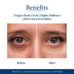Blue Nectar Under Eye Cream For Dark Circles Natural Niacinamide