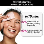 ThriveCo Goodbye Acne Kit
