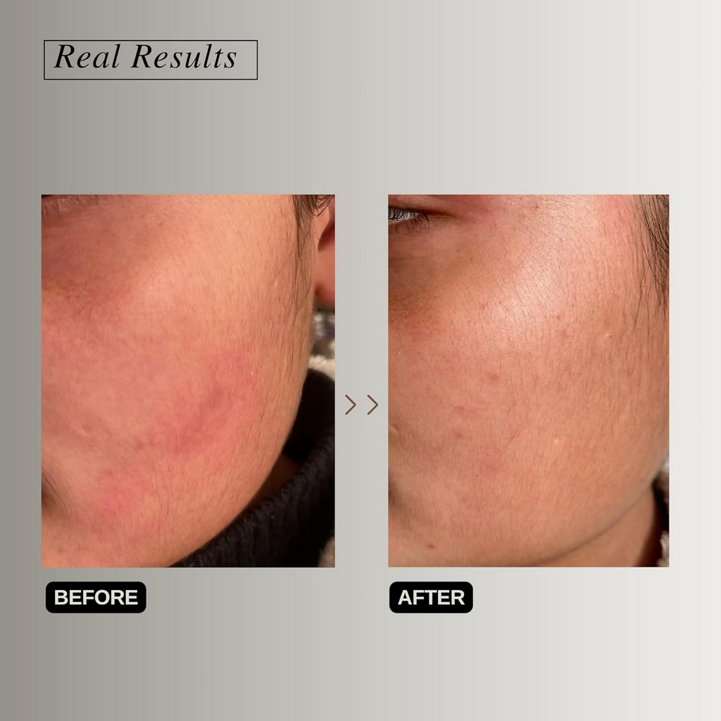 The Formularx Peptide Ceramide Moisturizer - Barrier Plus - Distacart