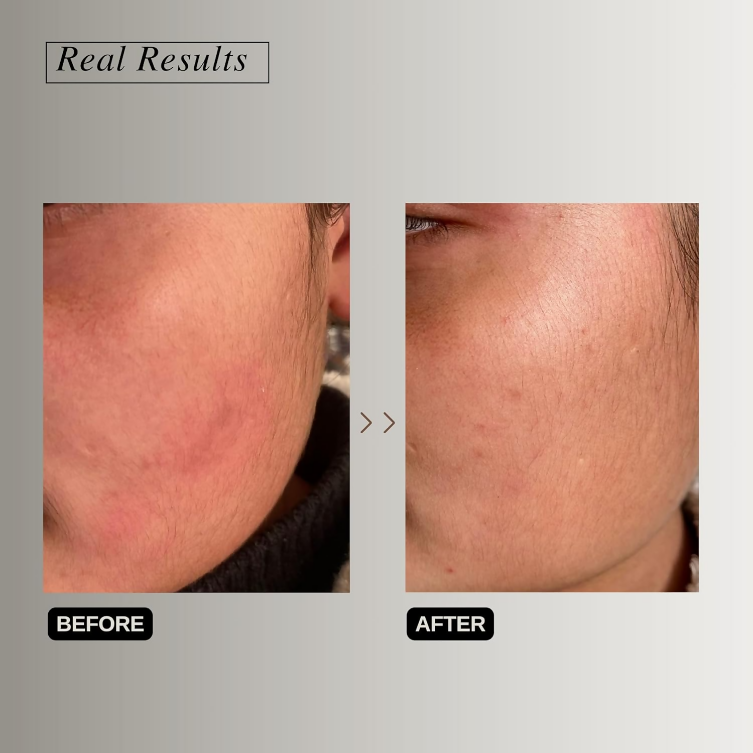 The Formularx Peptide Ceramide Moisturizer - Barrier Plus - Distacart